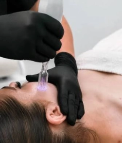 Fusion Plasma - Látványos bőrmegújítás